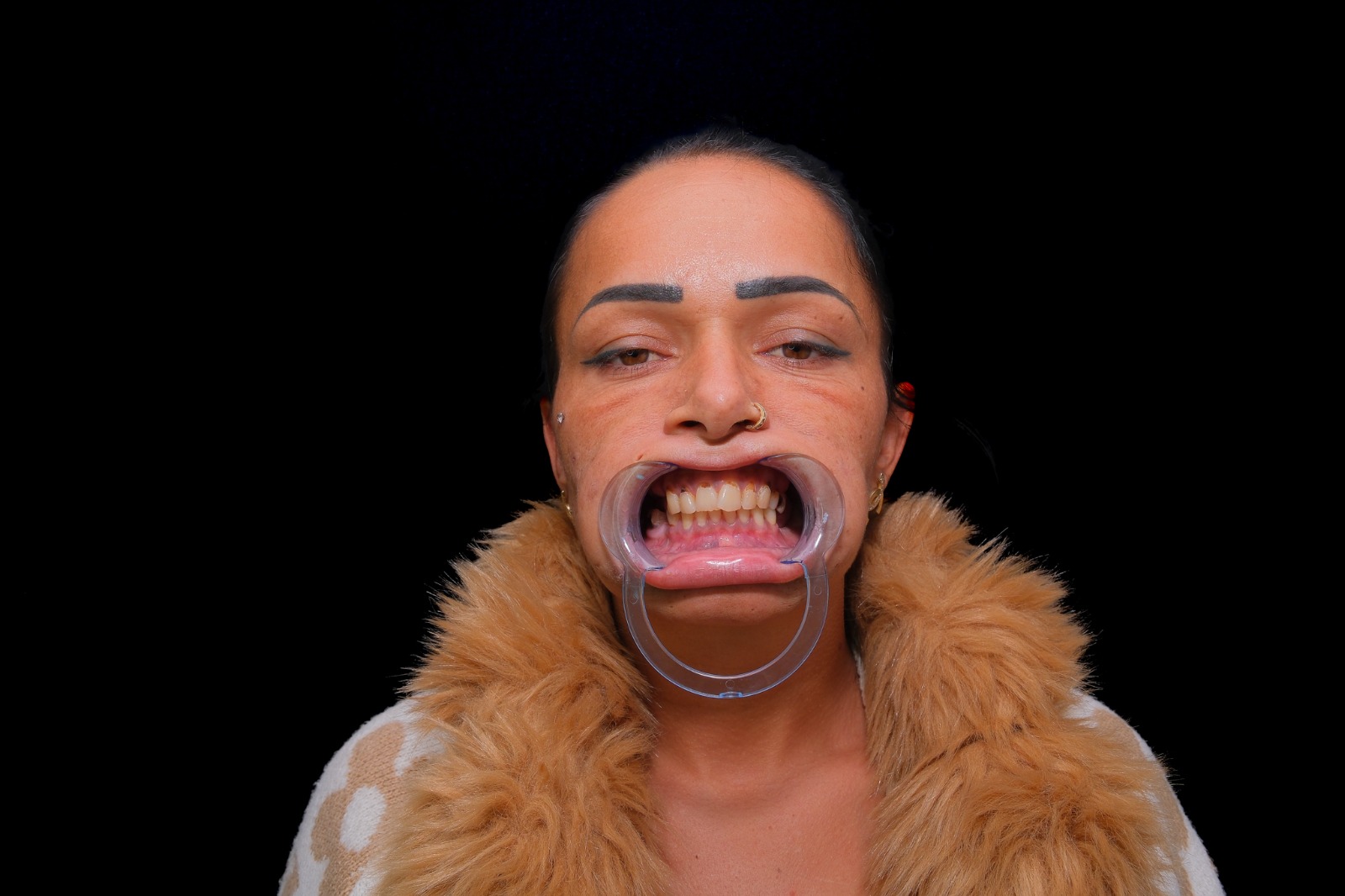 Before and after dental case 3