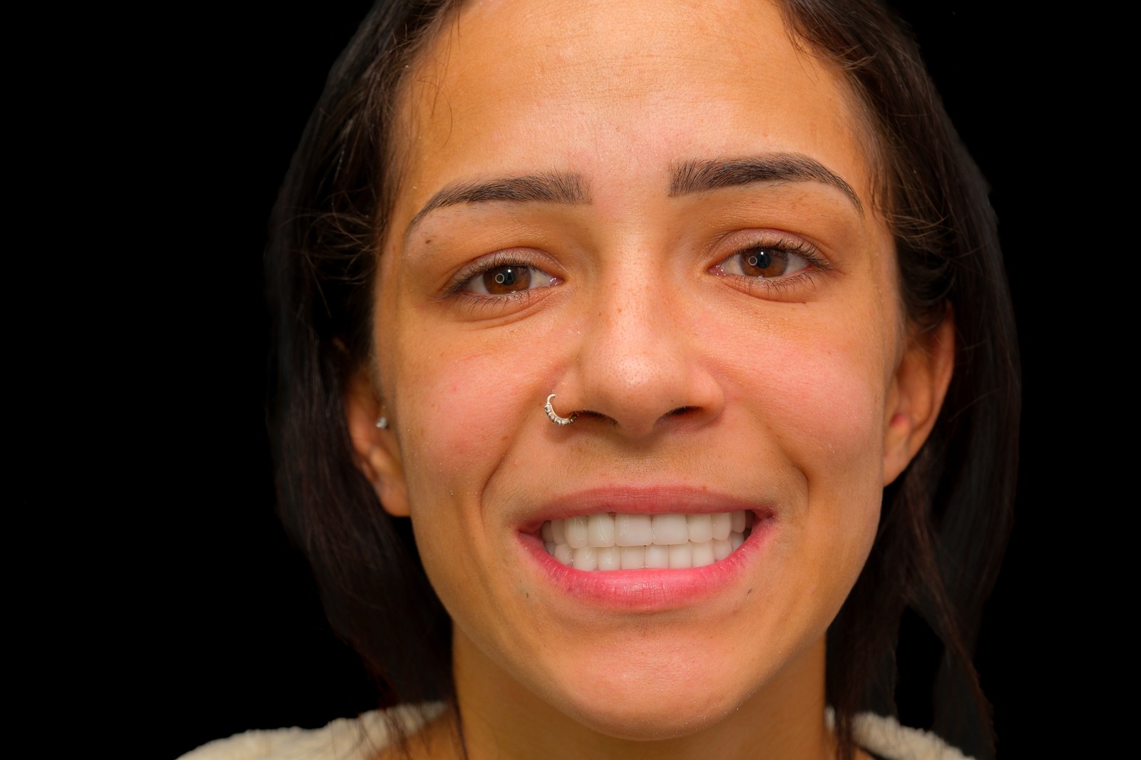 Dental smile result close-up